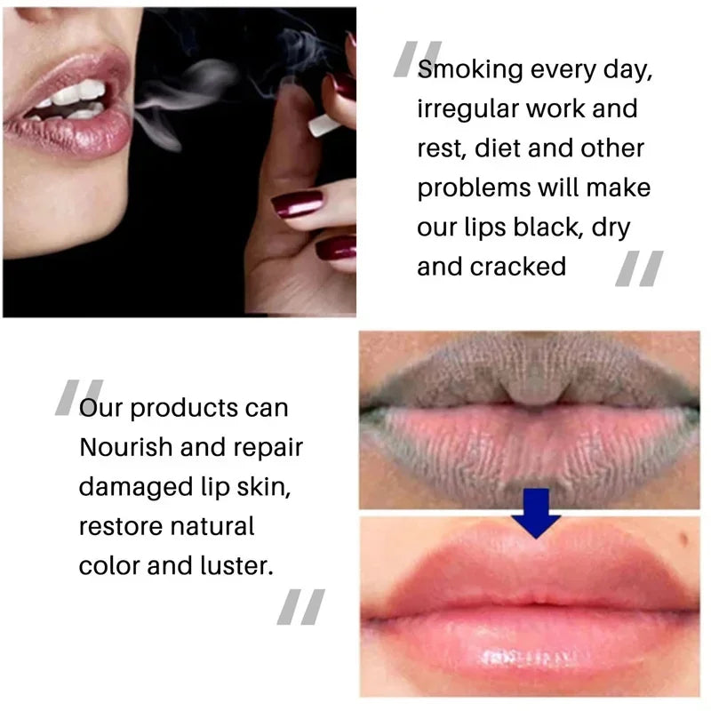 Remove Dark Smoke Lip Balm – Huile Gloss Éclaircissante & Exfoliante pour Lèvres Roses.