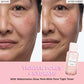 Tonique Visage Pastèque PHA + BHA 150ml – Soin Coréen, Réducteur de Pores, Acide Hyaluronique, Exfoliant Doux Raffermissant