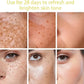Sérum Anti-Taches & Éclat Coréen – Jour & Nuit, Anti-Pigmentation