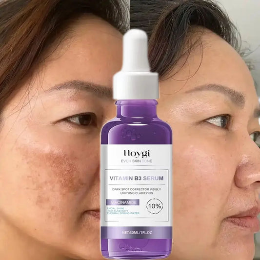 Sérum Anti-Taches & Éclat Coréen – Jour & Nuit, Anti-Pigmentation