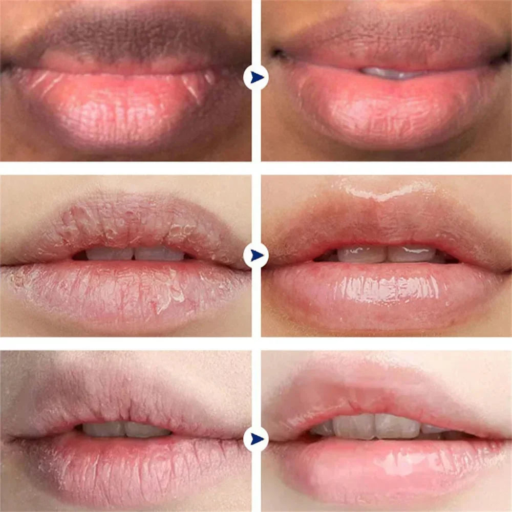 Remove Dark Smoke Lip Balm – Huile Gloss Éclaircissante & Exfoliante pour Lèvres Roses.