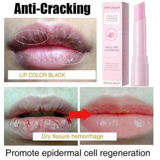 Remove Dark Smoke Lip Balm – Huile Gloss Éclaircissante & Exfoliante pour Lèvres Roses.