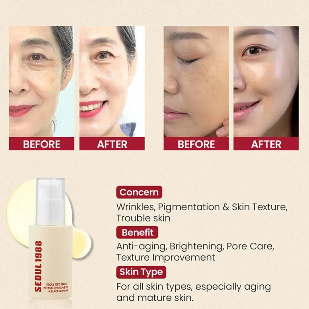 SEOUL 1988 Sérum Coréen – Hydratant, Éclaircissant, Vitamine C & Acide Hyaluronique, Anti-Taches & Réducteur de Pores