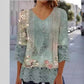 Casual Lace Printed Lace Button Top.